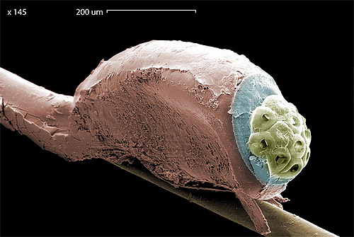 Še ena fotografija gnezd pod elektronskim mikroskopom