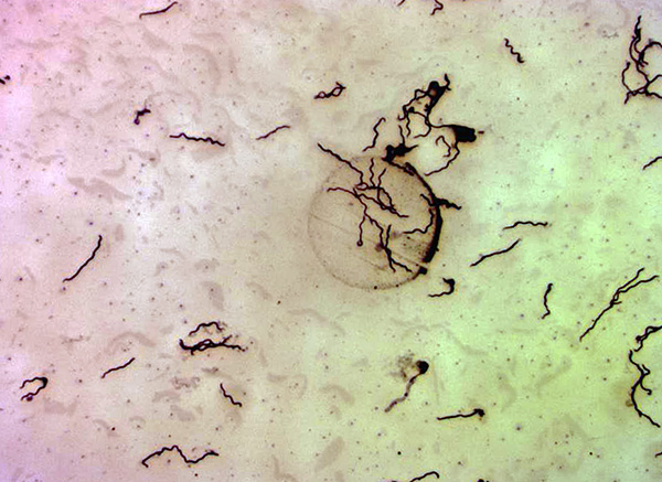 Borrelia Burgdorferi pod mikroskopom (s 400-kratnim povečanjem).