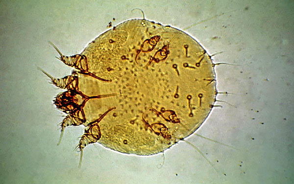 Srbenje srbenja aktivno dviga premike v koži, kar povzroča hudo srbenje in značilne dermatološke lezije.