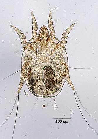 Otodectes cynotis pod mikroskopom, odrasli posameznik