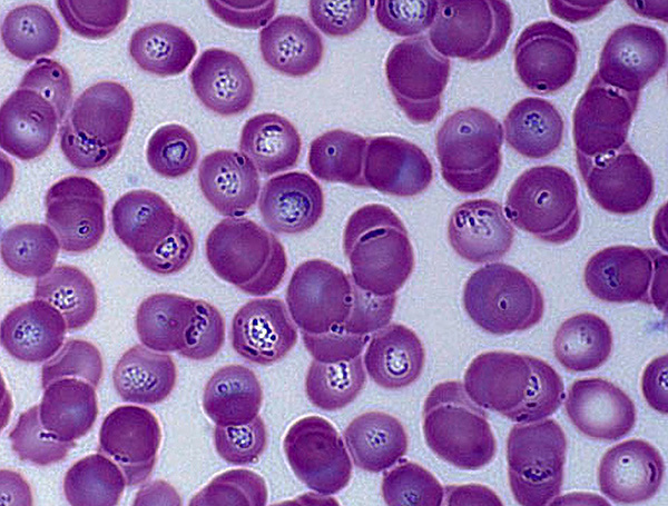 To je tisto, kar je kri pacienta s piroplazmozo pod mikroskopom videti - piroplazma je jasno vidna v rdečih krvnih celicah.